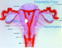 gynecological